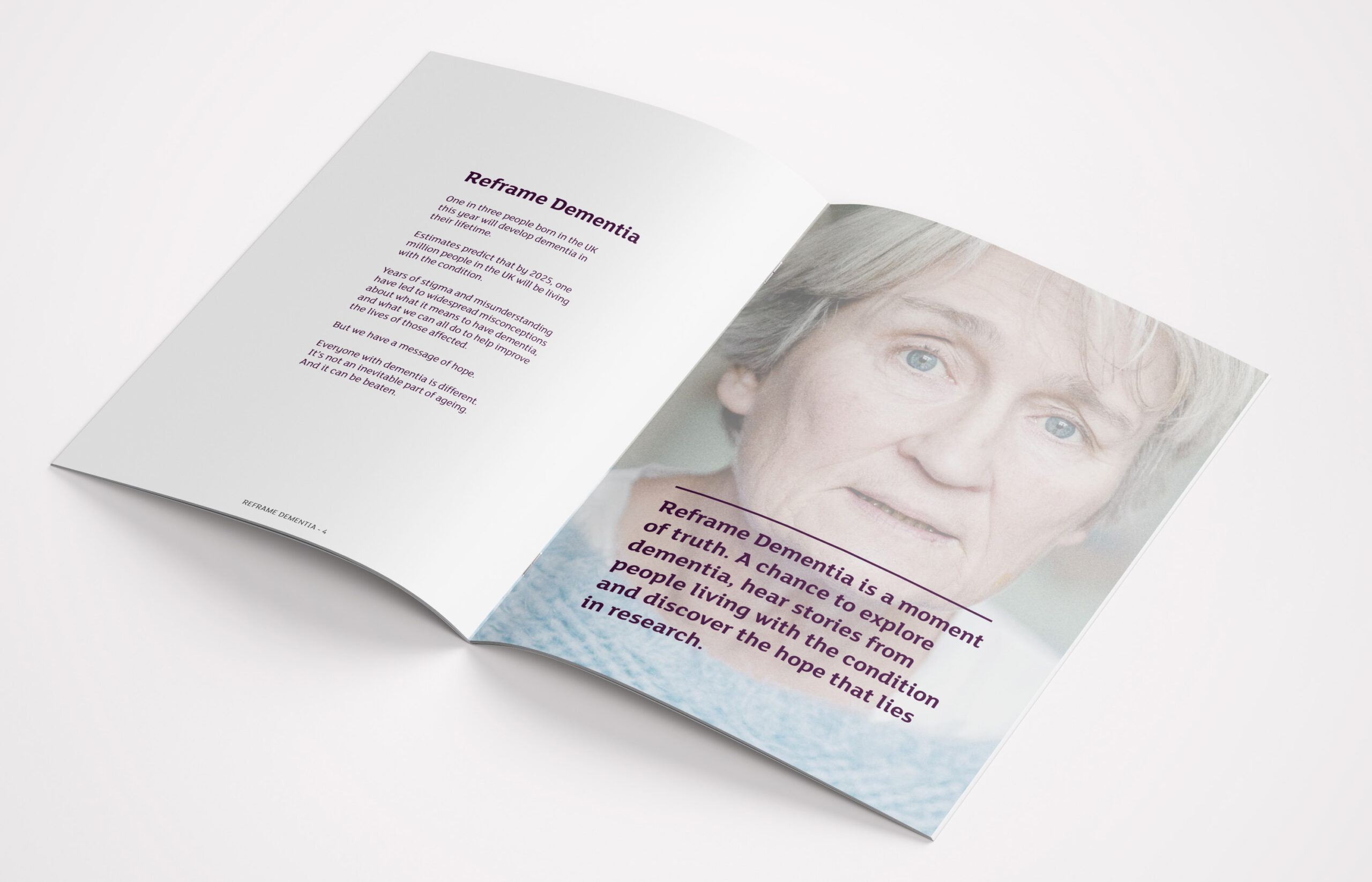 Alzheimer’s Research Brochure